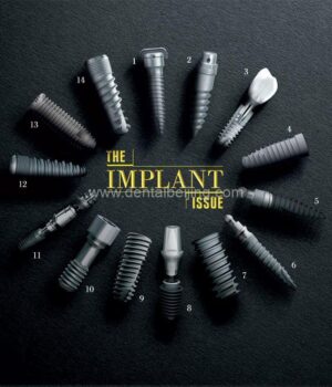 dental-implants-beijing-cover.jpg