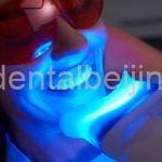 teeth-whitening-process