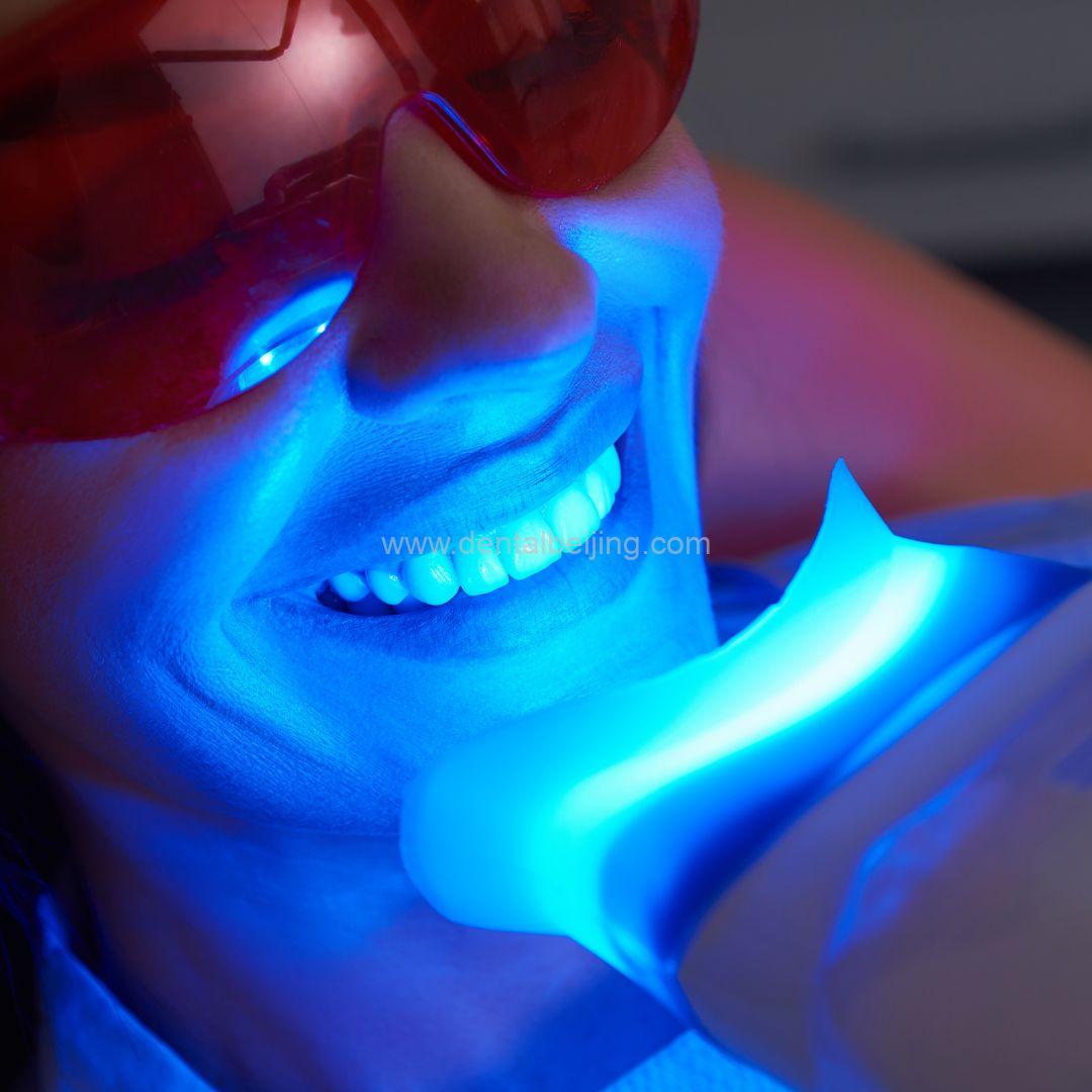 teeth-whitening-process