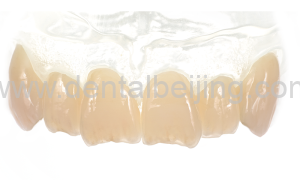 Dentsply-Sirona-celtra-press