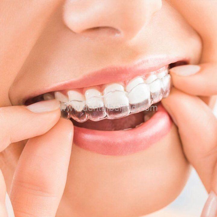 dental retainer
